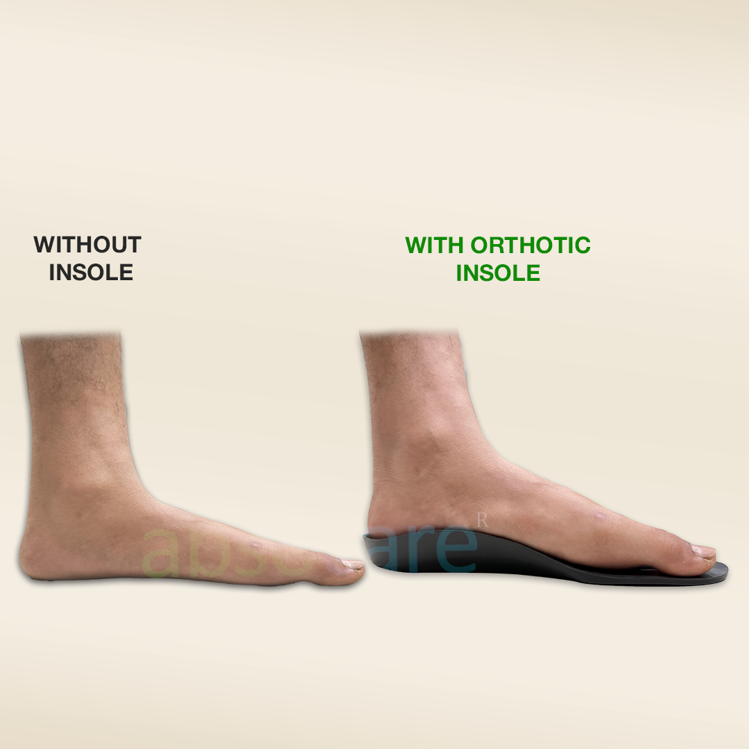 Orthopedic Insole